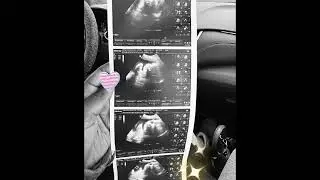 K Dawg - Khylinn(babygirl)