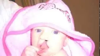 Cleft Lip, Cleft Palate: What advice would you give to other parents?