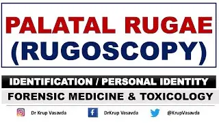 Rugoscopy | Palatal Rugae | Identification | Dr Krup Vasavda