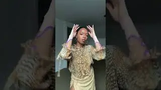 Vitiligo Photoshoot (Artspots Edition)