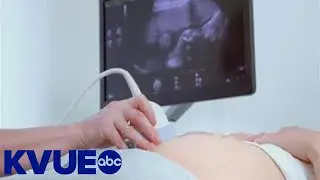 SAFE Children's Shelter helps pregnant, parenting teens in Texas foster care | KVUE