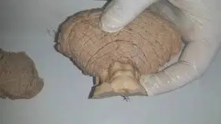 Midbrain -  External features & Section at Superior Colliculus