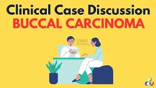 Oral cancer - Clinical Case Presentation | Buccal Carcinoma | Long case