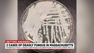 Superbug Candida auris found in Massachusetts and more than half of U.S. states