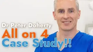 All-on-4 Dental Implants. A Case Study with Dr Peter Doherty