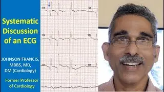 Systematic Discussion of an ECG