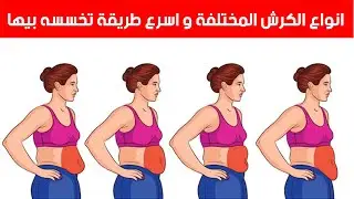 انواع الكرش المختلفة و أسهل طريقة تتخلص منه !