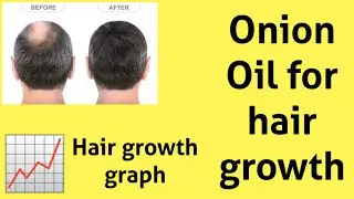 How to make Onion Oil for hair growth?