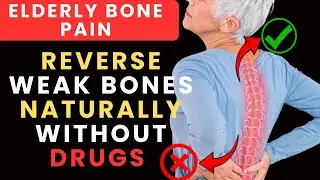 Over 65? Elderly Bone Pain Warning - 5 Dangerous Mistakes Making It Worse #DoctorMurphy