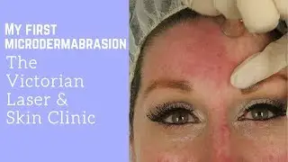 My first ever Microdermabrasion at the Victorian Laser & Skin Clinic