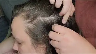 Asmr Scalp Check, Dandruff Scratching, Nitpicking, Relaxing Sleep Triggers