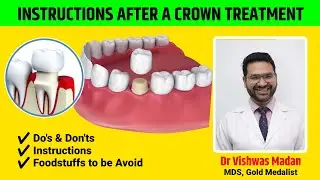 What Precautions one need to Take after Dental Crown - Dr Vishwas Madan | Instructions after a Crown