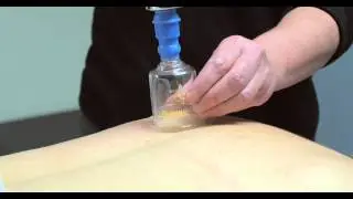 Massage therapy, lymphedema and lymphatic drainage for cancer care