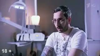 На 10 лет моложе - Как заменить металлические стальные коронки