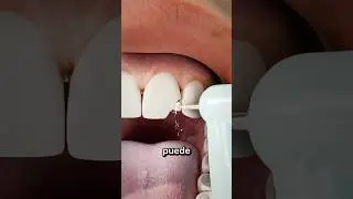 C&oacute;mo Arreglar Un Diente Roto 🦷
