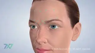 Botox | 7x7 Dental Implant and Oral Surgery Specialists | San Francisco, CA