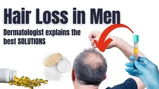 Hair Loss in Men | Secrets to early & effective treatments | Dermatologist explains.