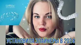 УСТАНОВИЛА ЭЛАЙНЕРЫ | МОЯ ИСТОРИЯ | ПЛЮСЫ И МИНУСЫ | СКОЛЬКО СТОИТ?