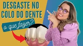 Desgaste no colo do dentes. Adornare Odontologia em Santos