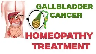 Carcinoma of Gall Bladder improved by Homoeopathic treatment.