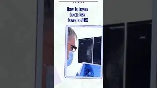 How To Lower Cancer Risk Down to ZERO #shorts