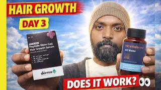 Using Hair Growth Serum & DHT Blocker | Day 3 Real Update