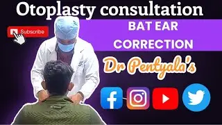 Pre surgery consultation of Otoplasty / Ear Reshaping Surgery / Bat Ears #drpentyalas #otoplasty
