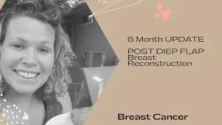 6 month post DIEP update