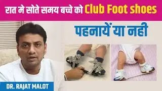 रात मे सोते समय बच्चे को Club Foot shoes पहनायें या नही | Dr. Rajat Malot