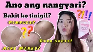POND'S WHITE BEAUTY SERUM BURST CREAM REVIEW 2021 | Syne Dela Cruz