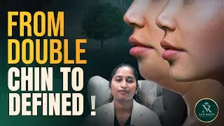 Lose Double Chin & Face Fat Fast | Exercises That Work 😱 | Double Chin Removal