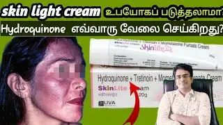 Skin light cream பக்கவிளைவுகள் என்ன?/Hydroquinone mode of action /medical awareness in tamil