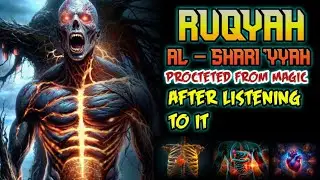 RUQYAH AL SHARIYYAH PROTECTED FROM MAGIC AFTER LISTENING TO IT.ALAA AQELL