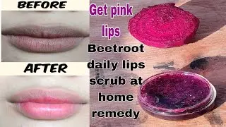 Get pink lips Naturally beetroot daily lips scrub at home remedy, soft and pink lips