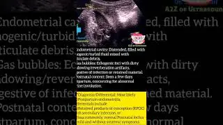 Ultrasound: Postpartum Endometritis #ultrasound #radiology #gynecology #endometrium