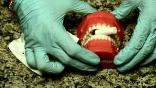 How Invisalign Works and How To Care For Your Aligners To Speed Up Treatment