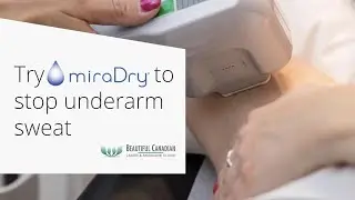 Vancouver miraDry&reg; Provider: Explaining the Armpit Sweat Solution for Hyperhidrosis
