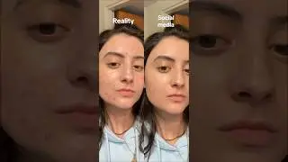 Why you shouldn&rsquo;t compare yourself to people online&hellip; #viralbeauty #skinpositivity  #socialmedia