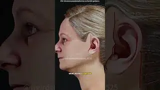 Mini Facelift Surgery #relaxingmusic #adventure #music #love #automobile #doctor #3danimation