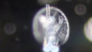 Testudinella patina
