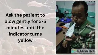 UBT (Urea Breath Test) for H pylori detection.