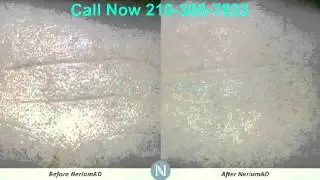 Nerium Skin Care Results | 210-305-7833