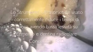 Root Surface Debridement