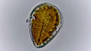 Surirella Diatom