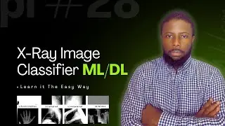 X-Ray Image Classification &mdash; Machine Learning Made Easy!