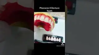 Art Of Making Dentures.