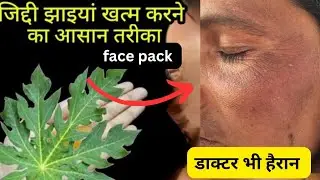 गोरा होने के लिए इस face pack को try करे| Papaya leaf face mask for glassskin| #facepack 