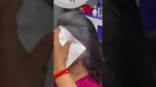 How to cover baldness|#baldness #scalphiding #scalping #trending #shortsviral #baldnesstreatment
