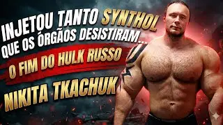 “EU FARIA TUDO DIFERENTE” – As Últimas Palavras do Hulk Russo Antes de Morrer