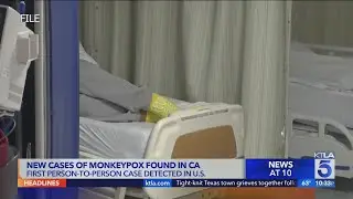 WHO: Monkeypox won&rsquo;t turn into pandemic, but many unknowns